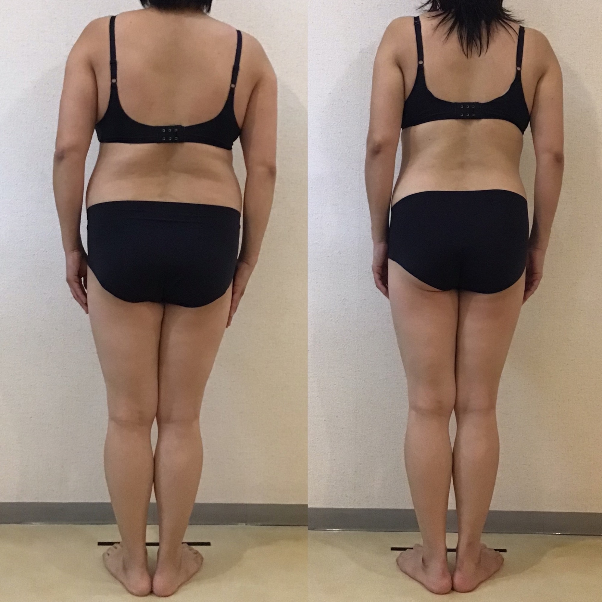 35歳−11、1kg達成！トリプル全身スリムビフォーアフター★｜岡崎市の痩身エステ施術例